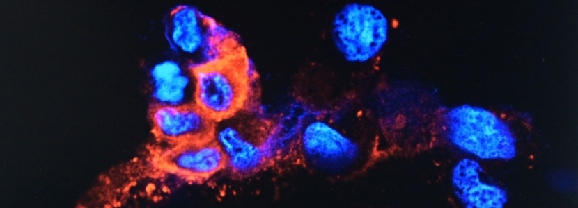 最新疫情通報(bào):奧密克戎毒株擾動(dòng)全球 多國收緊入境防疫措施