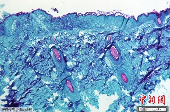 點(diǎn)擊進(jìn)入下一頁