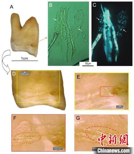 湖南道縣福巖洞8-12萬年前古人類剔牙行為的遺存痕跡?！清?供圖