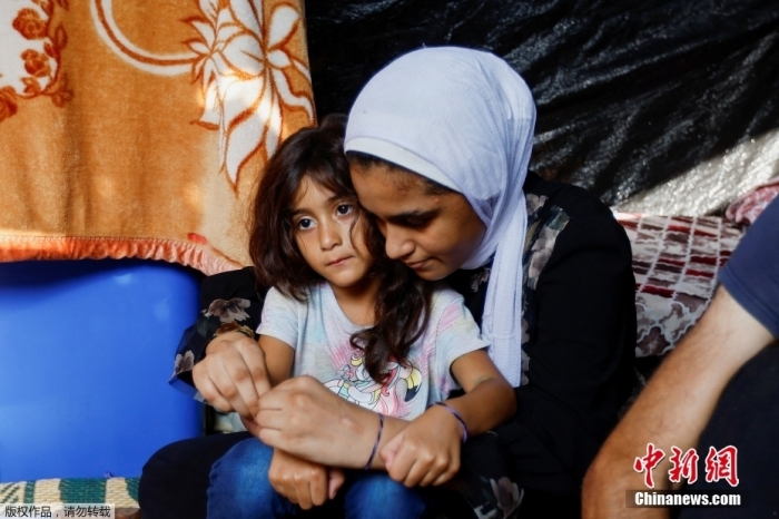 當?shù)貢r間10月24日，在加沙地帶南部的汗尤尼斯，巴勒斯坦男子阿里·達巴一家人在避難所展示了他們的手環(huán)。阿里·達巴和妻子因擔心孩子們在襲擊中喪生，決定把他們分開，如遇到不幸，可以用手環(huán)認出他們。